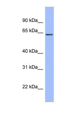 RPA70 / RPA1 Antibody (aa359-408)