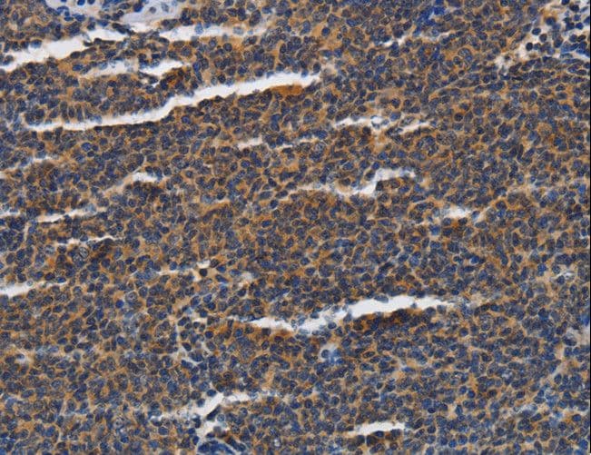 Polyclonal Rabbit anti-Human PIAS2 / PIASX Antibody (IHC)