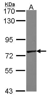 Polyclonal Rabbit anti-Human GALNT7 Antibody (aa24-515, IHC, WB)