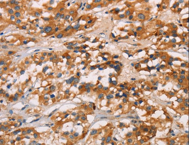 CD80 Antibody