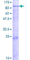 Human PCCA Protein (Recombinant GST)