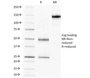 CGB / hCG Beta Antibody (clone HCGb/211)