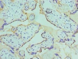 Polyclonal Rabbit anti-Human CSRNP1 / AXUD1 Antibody (aa1-200, IHC)