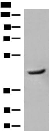 Polyclonal Rabbit anti-Human GCAT Antibody (WB)