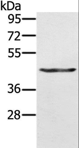 KRT31 / Keratin 31 / KRTHA1 Antibody