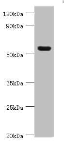 VTN / Vitronectin Antibody (aa364-478)