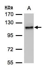 Polyclonal Rabbit anti-Human ADAMTSL2 Antibody (aa796-951, IHC, WB)