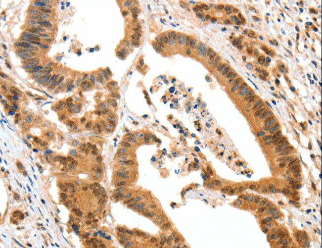 Polyclonal Rabbit anti-Human HTR3A / 5-HT3A Receptor Antibody (IHC)