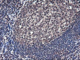 COPS5 / JAB1 Antibody (clone OTI2B12)