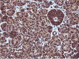PSMB7 Antibody (clone OTI1E1)