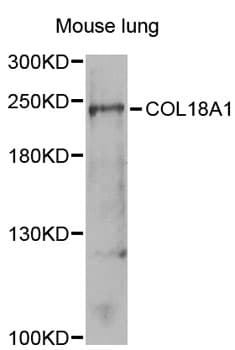 Endostatin Antibody