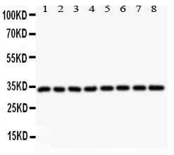 Polyclonal Rabbit anti-Human CCND3 / Cyclin D3 Antibody (aa136-292, WB)