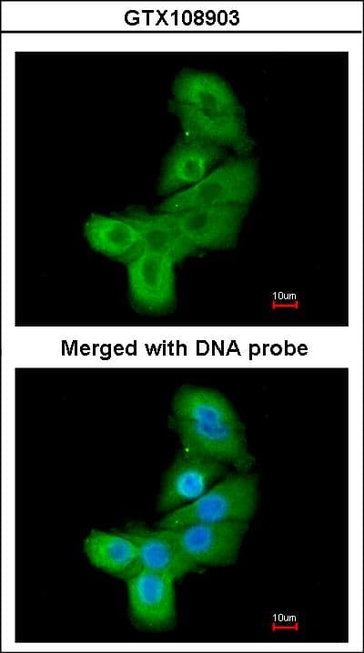 LIMK2 Antibody (aa1-252)