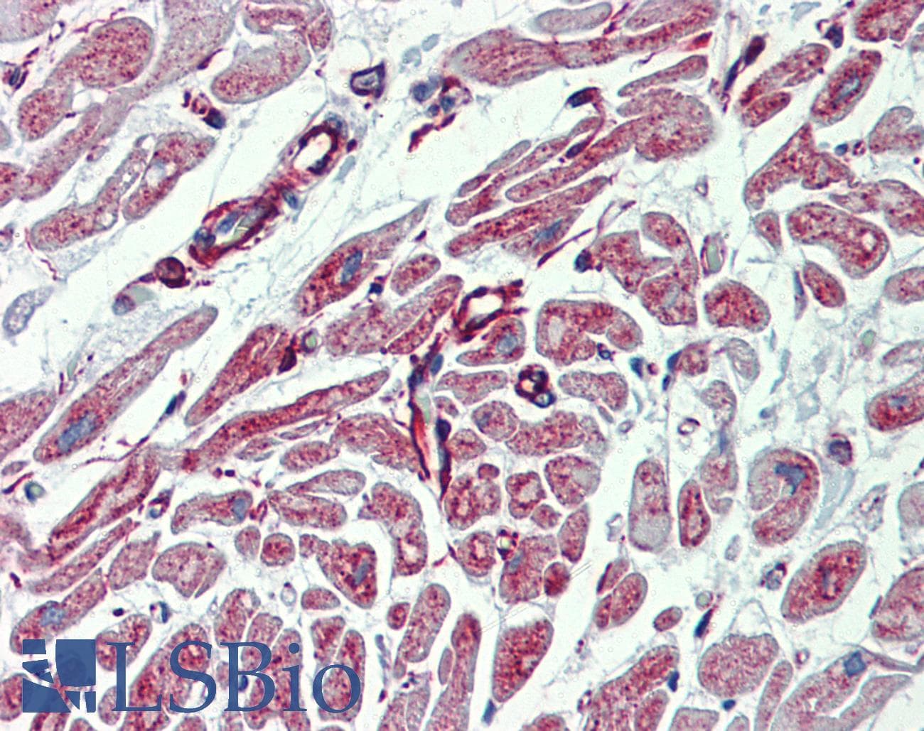 Polyclonal Rabbit anti-Human PHACTR1 Antibody (aa468-517, IHC, WB)