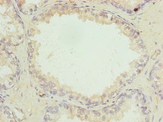 ACSBG1 / hsBG Antibody