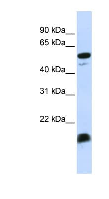 C4BPA / C4BP Alpha Antibody (C-Terminus)