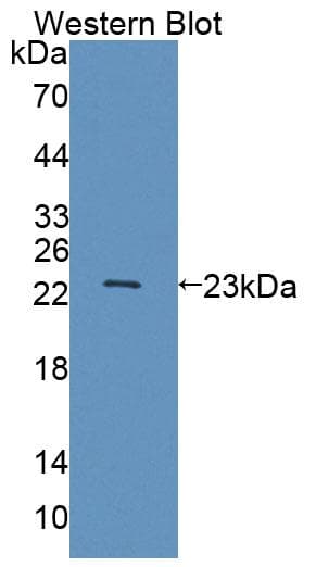 ABCA9 Antibody (PE)