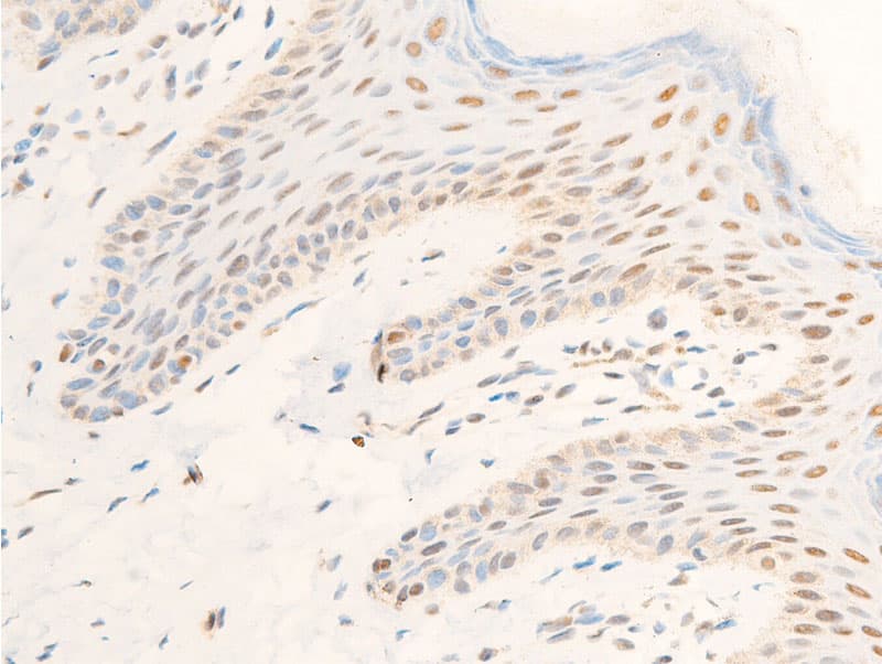 Polyclonal Rabbit anti-Human TK1 / TK / Thymidine Kinase Antibody (phospho-Ser13, IHC, IF, WB)