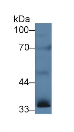INHA / Inhibin Alpha Antibody (aa25-363)