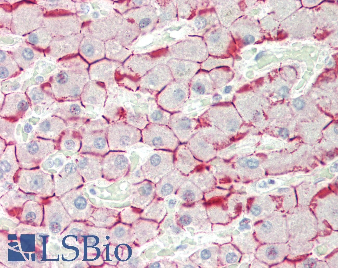 PathPlus™ CDH1 / E Cadherin Antibody (clone 813CT11.1.3)