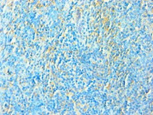 Polyclonal Rabbit anti-Human TFEB Antibody (aa1-220, IHC, WB)
