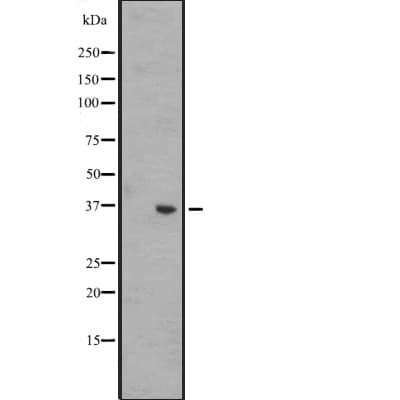 WNT8B / Wnt 8b Antibody