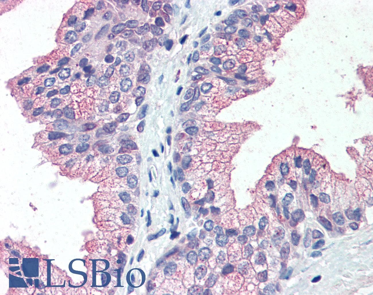 IHC-plus™ Polyclonal Rabbit anti-Human SLC39A14 / ZIP14 Antibody (Internal, IHC)