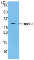 MUC16 / CA125 Antibody (aa2-258)