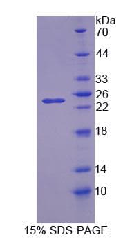 Mouse NT5M Protein (Recombinant)
