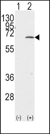 Polyclonal Rabbit anti-Human PIAS1 Antibody (aa607-637, IHC, WB)