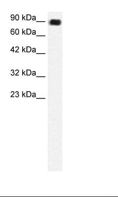 C13orf8 / ZNF828 Antibody (aa261-310)