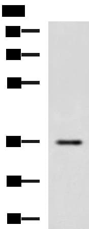 IBSP / Bone Sialoprotein Antibody
