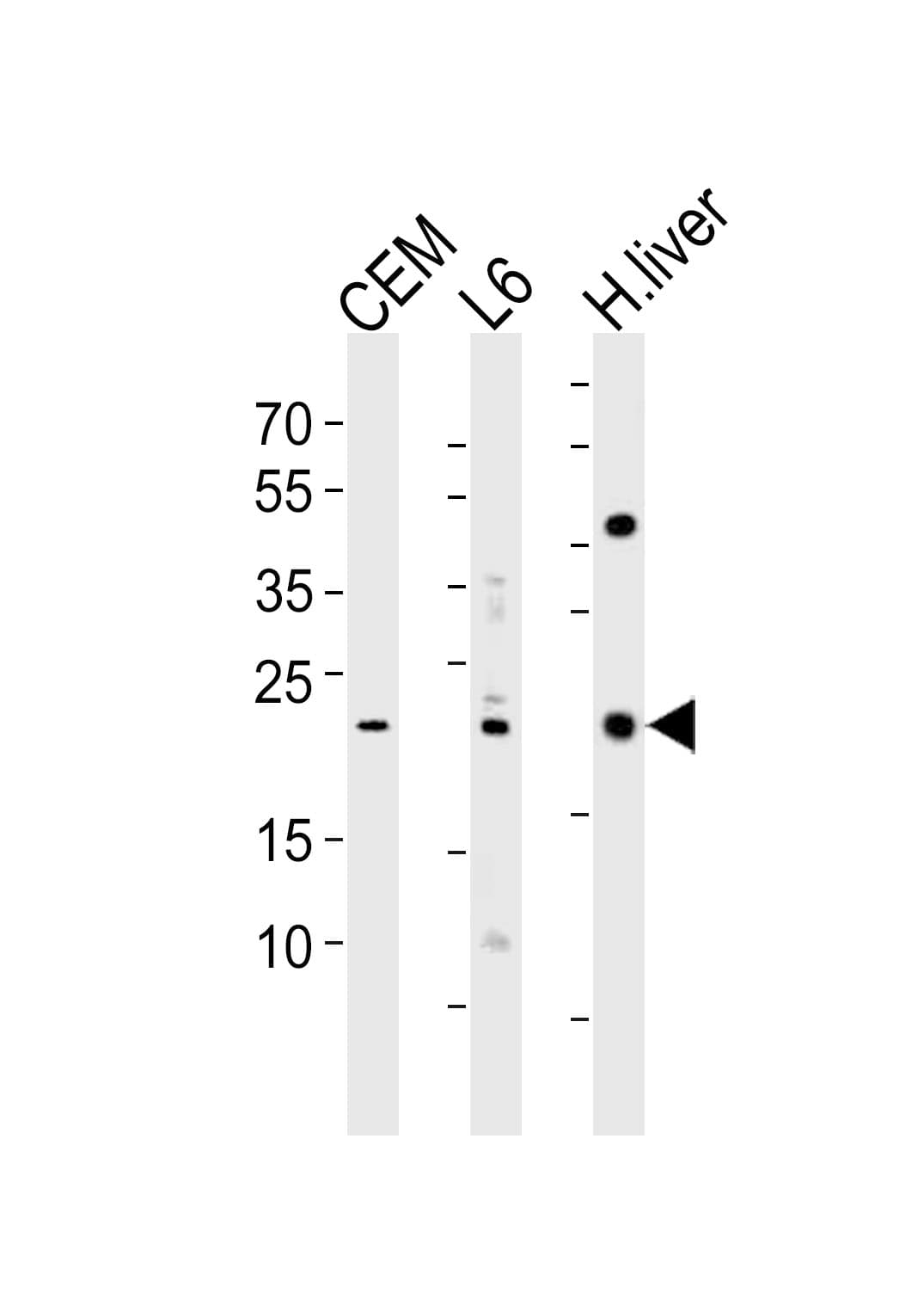PEMT Antibody (aa1-30)