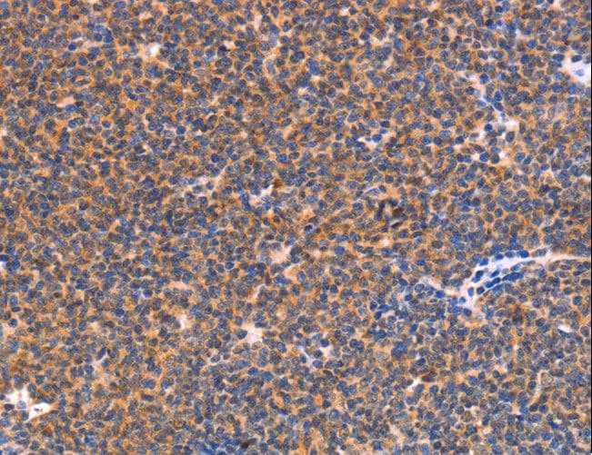 Polyclonal Rabbit anti-Human NES / Nestin Antibody (IHC)