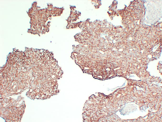 Monoclonal Mouse anti-Human AMACR / P504S Antibody (clone ABT-AMACR, IHC, WB)