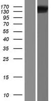 FMNL1 Protein (Over-Expression Lysate Myc-DDK (Flag))