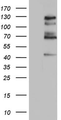 GLI / GLI1 Antibody (aa755-1106, clone OTI2C10)