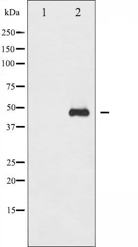 Polyclonal Rabbit anti-Human GATA1 Antibody (phospho-Ser310, IF, WB)
