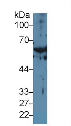 KRT1 / CK1 / Cytokeratin 1 Antibody (aa489-625, Biotin)