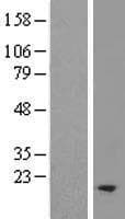 TM2D2 Protein (Over-Expression Lysate Myc-DDK (Flag))