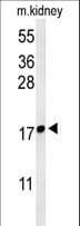 LYPD1 Antibody (aa93-122)