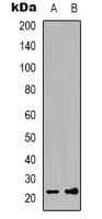 FGF12 Antibody (Internal)