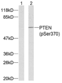 Polyclonal Rabbit anti-Human PTEN Antibody (IHC, IF, WB)