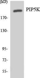 Polyclonal Rabbit anti-Human PIKFYVE / PIP5K Antibody (aa46-95, WB)