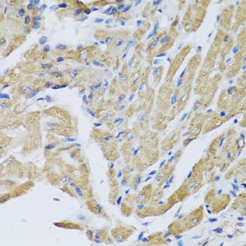 IHC-plus™ Polyclonal Rabbit anti-Human CRHBP Antibody (IHC, IF, WB)