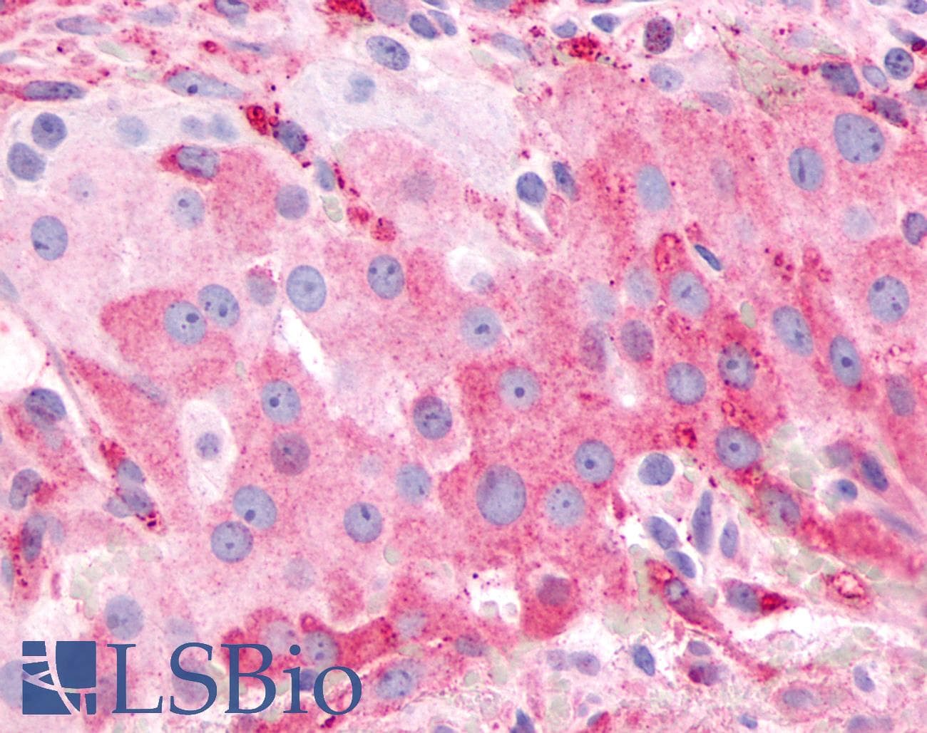 PathPlus™ FP / PTGFR Antibody (Extracellular Domain)
