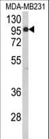 BAHD1 Antibody (aa750-777)