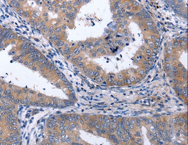 NPPB / BNP Antibody