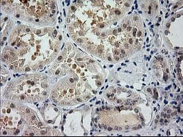 GSS / Glutathione Synthetase Antibody (clone OTI1B8)