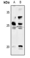 TK1 / TK / Thymidine Kinase Antibody